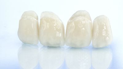 Коронки из диоксида циркония